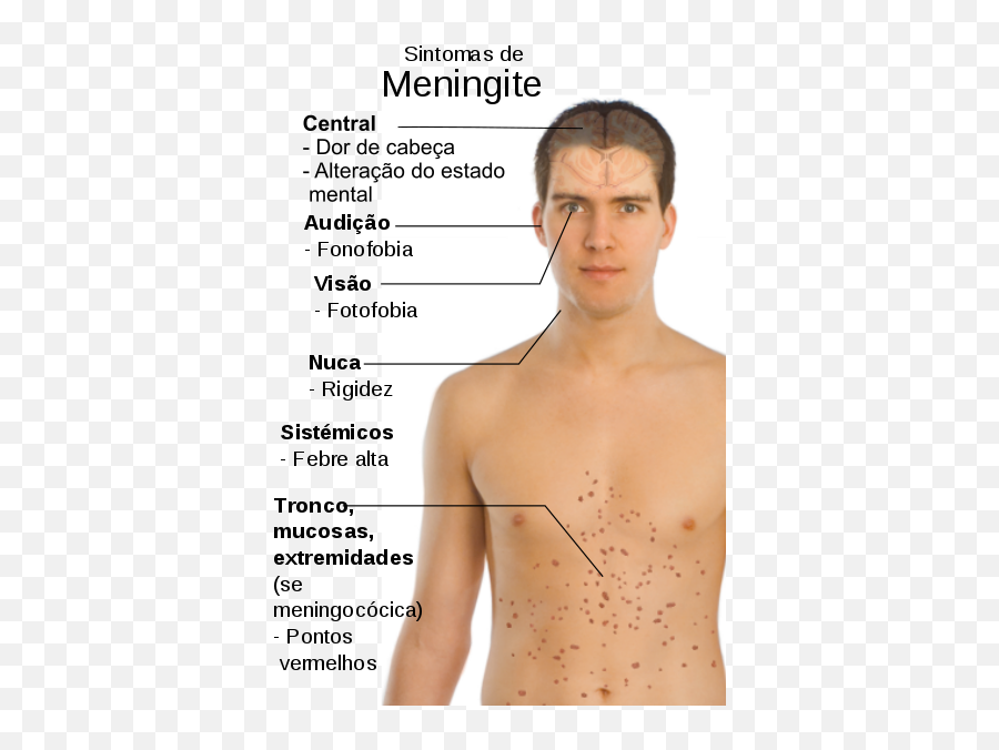 Pt Version - Meningitis Symptoms Emoji,Most Common Emojis