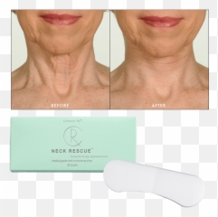 Contours Rx NECK RESCUE Non - Surgical Correcting Strips 30 Pack Health Care Emoji
