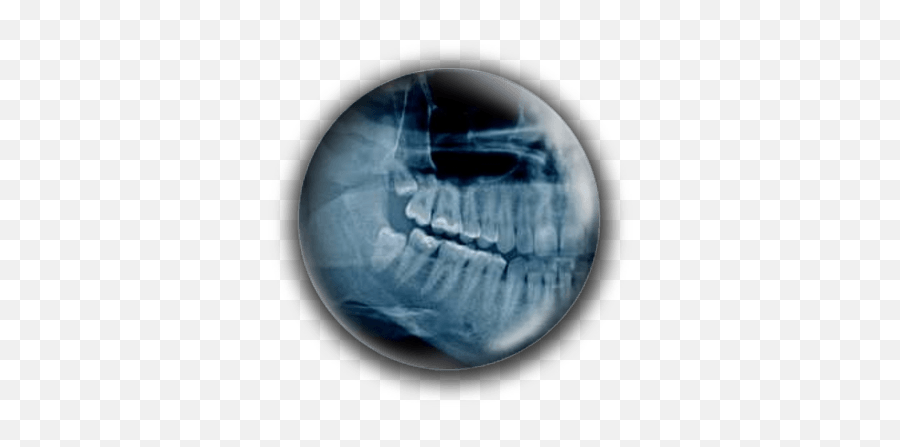 Park Street Dental Practice Weymouth Dorset Uk Affordable - Wisdom Tooth Rtg Emoji,Tooth Emoticon