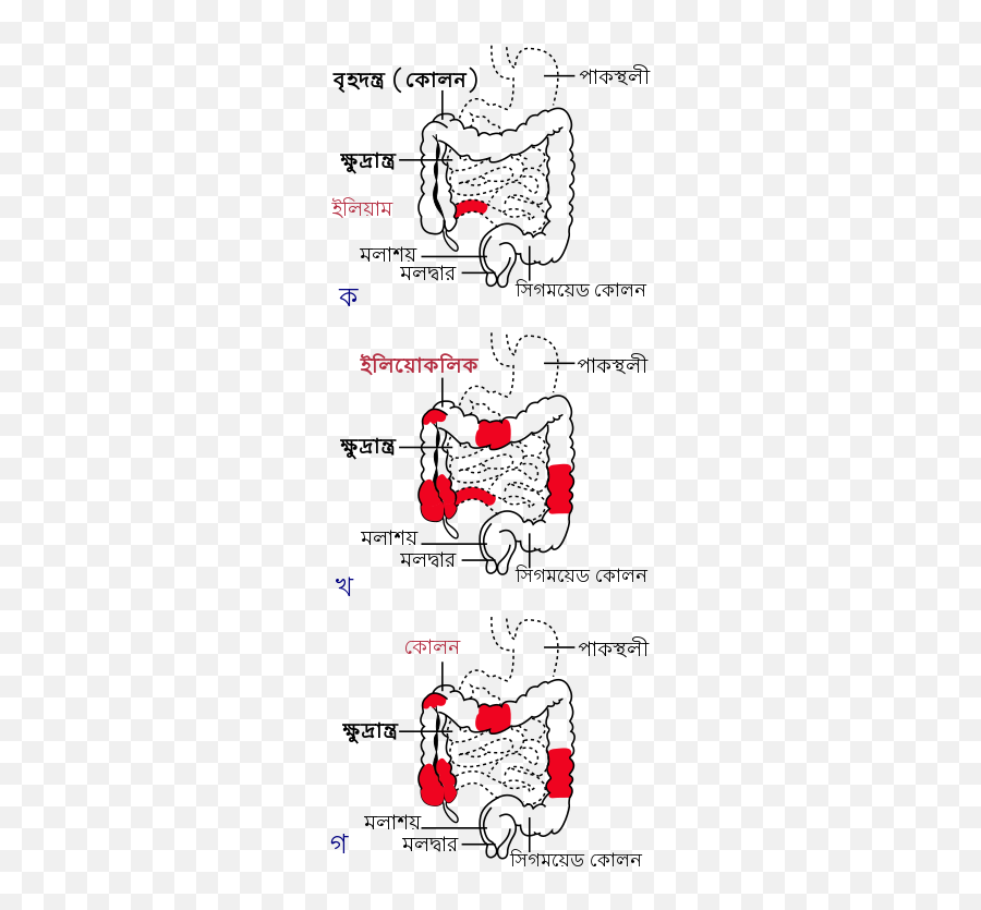 Patterns Of Crohns Disease - Disease Emoji,Emoji Patterns To Copy