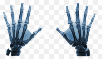 Free - Radiographie De La Main Emoji,X Ray Emoji