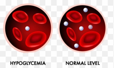 Hypoglycemia And Normal Glucose Level - Blood Vessels Emoji