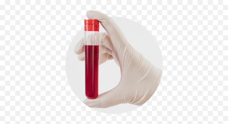 Stem Cell Thailand - Pruebas De Coagulacion Sanguinea Emoji,Test Tube Emoji