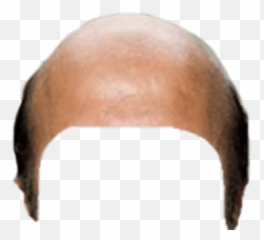 Snapchat Filter Dog Ears Transparent - Bald Head Emoji