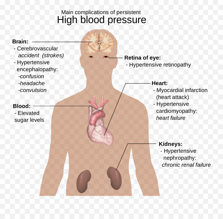 Stress Causes High Blood Pressure Emoji,Check Mark Emoji