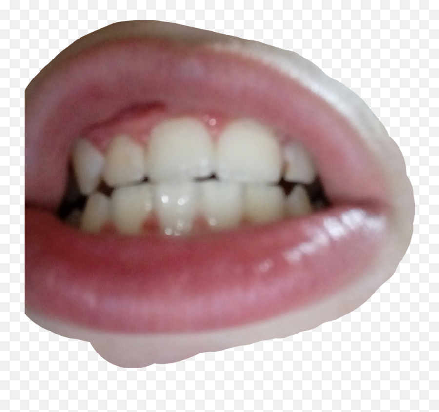 Toothache Stickers - Dentistry Emoji,Toothache Emoji