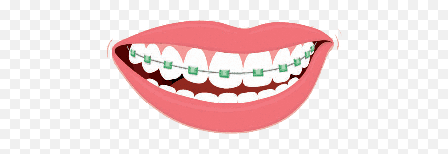 Braces Perfect Smile Transparent Png - Teeth Braces Clip Art Emoji,Missing Teeth Emoji