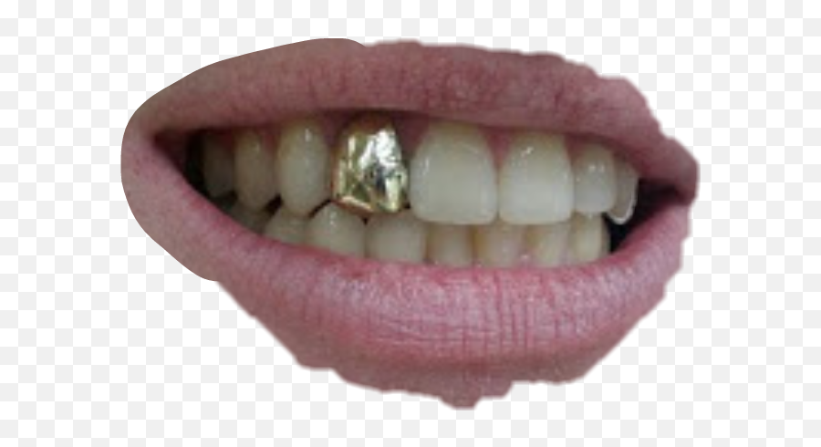 Toothache Stickers - Gold Tooth Cap Emoji,Toothache Emoji