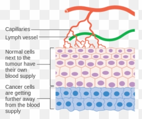 Diagram Showing Why Cancer Cells - Angiogenesis Meaning Emoji,Blood Type Emoji