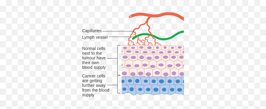 Diagram Showing Why Cancer Cells - Angiogenesis Meaning Emoji,Blood Type Emoji