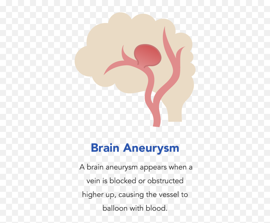 Brain Clip Transparent Png Clipart - Brain Aneurysm Png Emoji,Eggplant Emoji With Veins