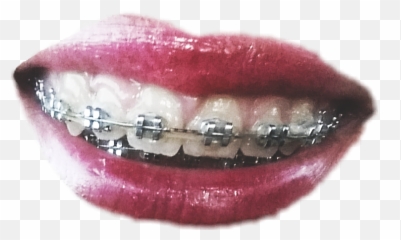 Trending - Canine Tooth Emoji
