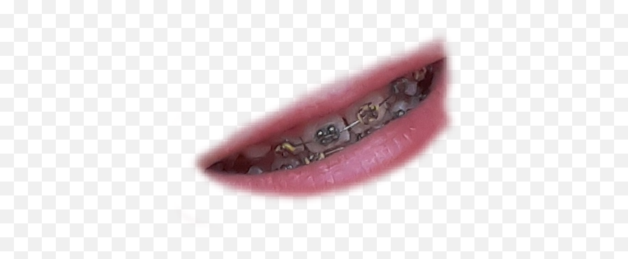 Largest Collection Of Free - Toedit Braceface Stickers Canine Tooth Emoji,Brace Face Emoji