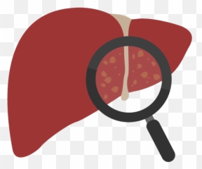 Gallstones In The Liver Clipart - Full Size Png Emoji
