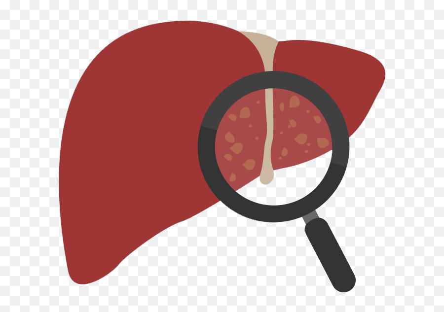 Gallstones In The Liver Clipart - Full Size Clipart Gallstones Clipart Png Emoji,Chestnut Emoji