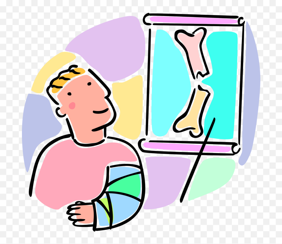 Vector Bone Arm Transparent Png - Arm Bone X Rays Cartoon Emoji,Broken Bone Emoji