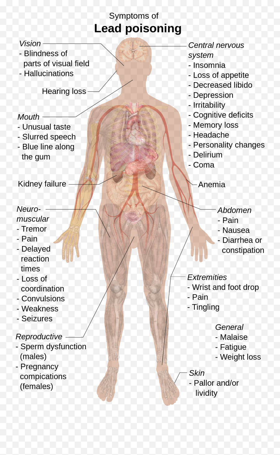 Symptoms Of Lead Poisoning - Lead Poisoning Symptoms Emoji,Weight Loss Emoji