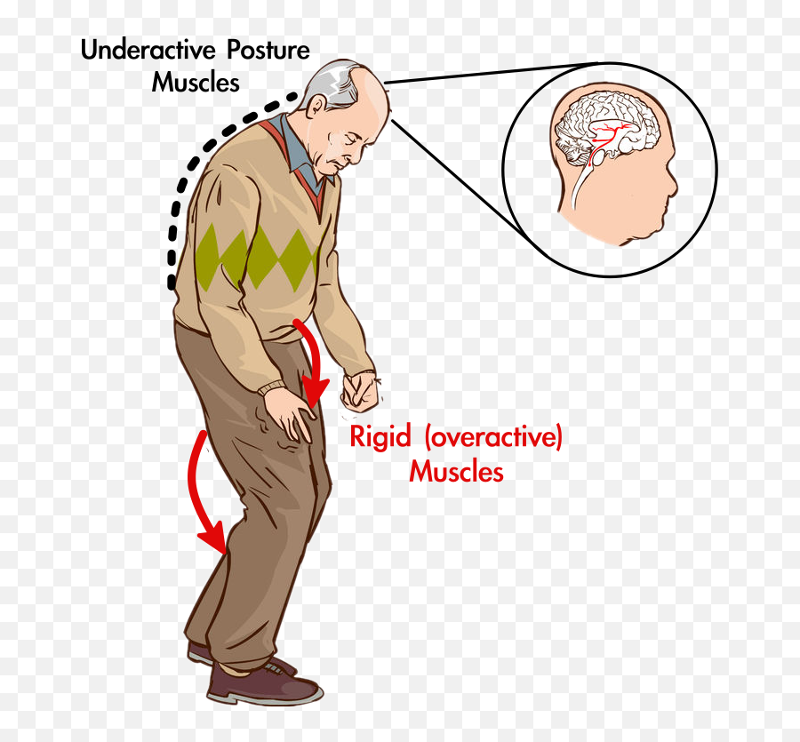 Best Exercises For Parkinsons Disease Orlando Neuro Therapy - Mal De Parkinson Dibujo Emoji,Flex Arm Emoji