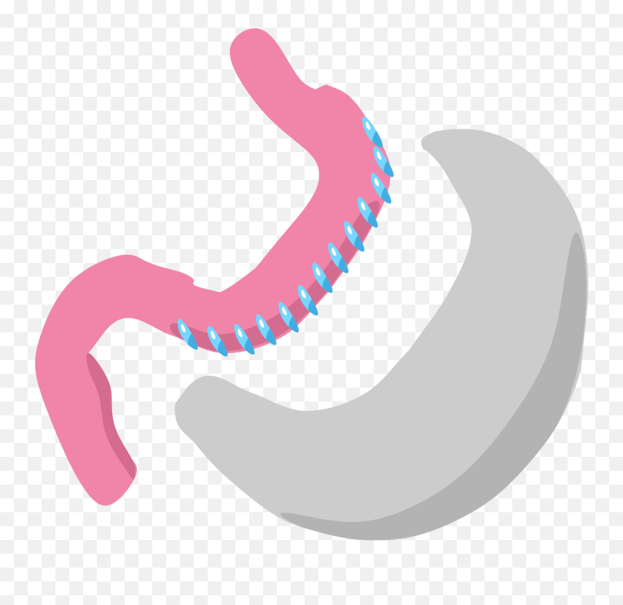 Sleeve Gastrectomy - Bariatrik Surgery Png Emoji,Test Tube Emoji
