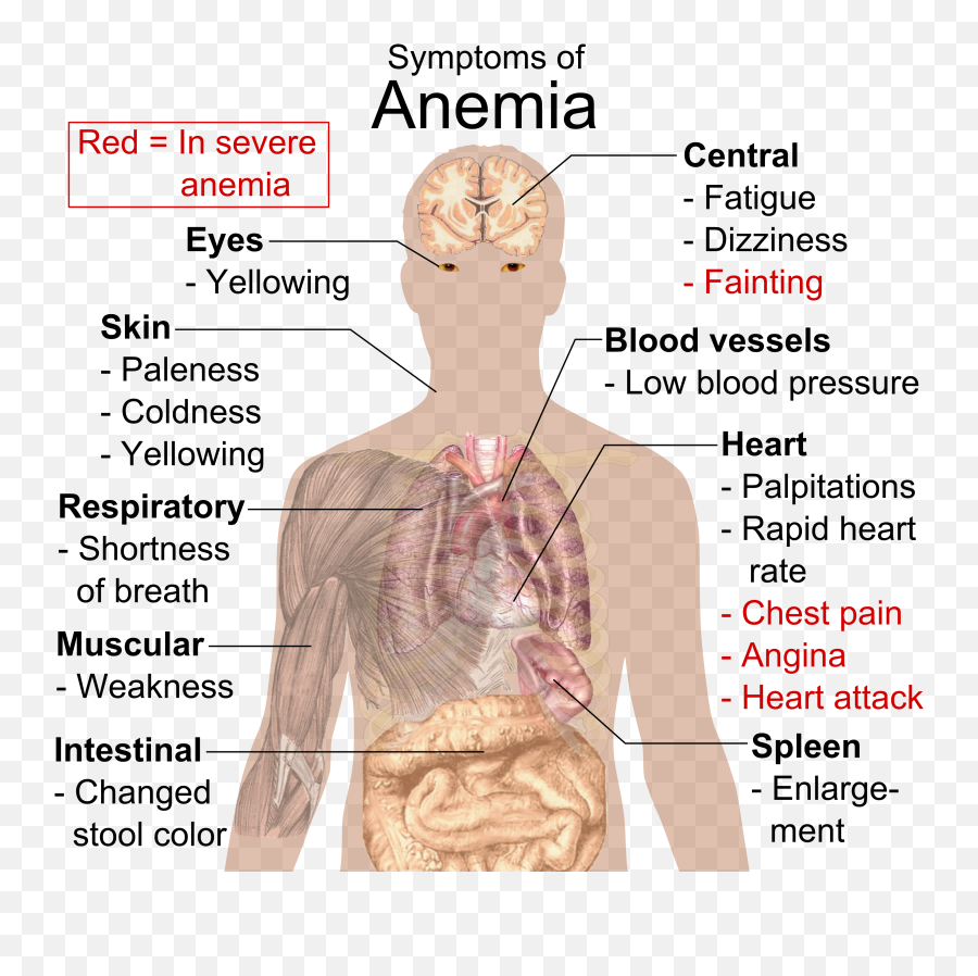 Symptoms Of Anemia - Symptoms Of Iron Deficiency Anemia Emoji,Side Eyes Emoji