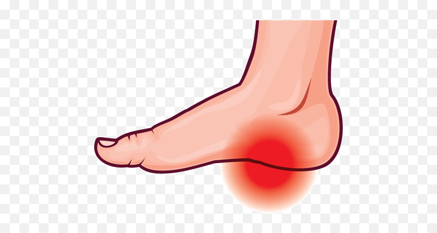 Feet Clipart Ankle - Clip Art Emoji,Broken Foot Emoji