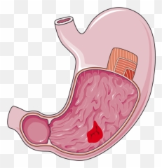 Stomach Clipart Transparent - Png Emoji