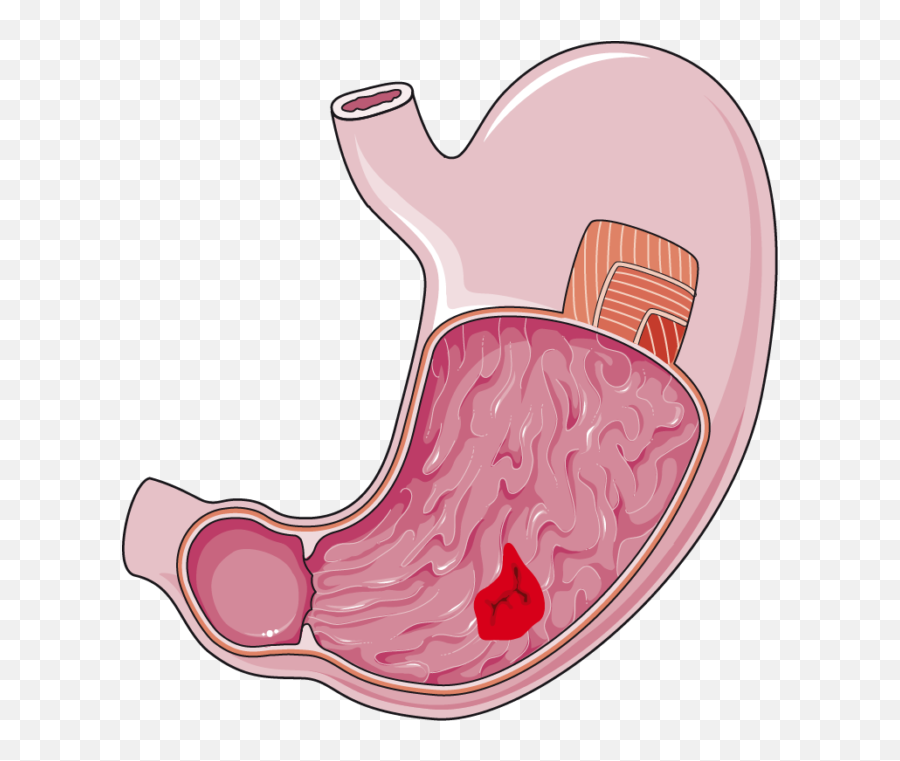 Stomach Clipart Transparent Stomach - Stomach Png Emoji,Stomach Emoji