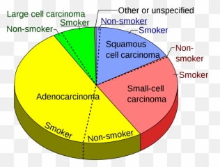 Pie Chart Of Lung Cancers - For Emoji