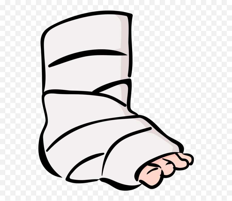 Broken Legs Png Picture - Broken Ankle Clipart Emoji,Broken Foot Emoji