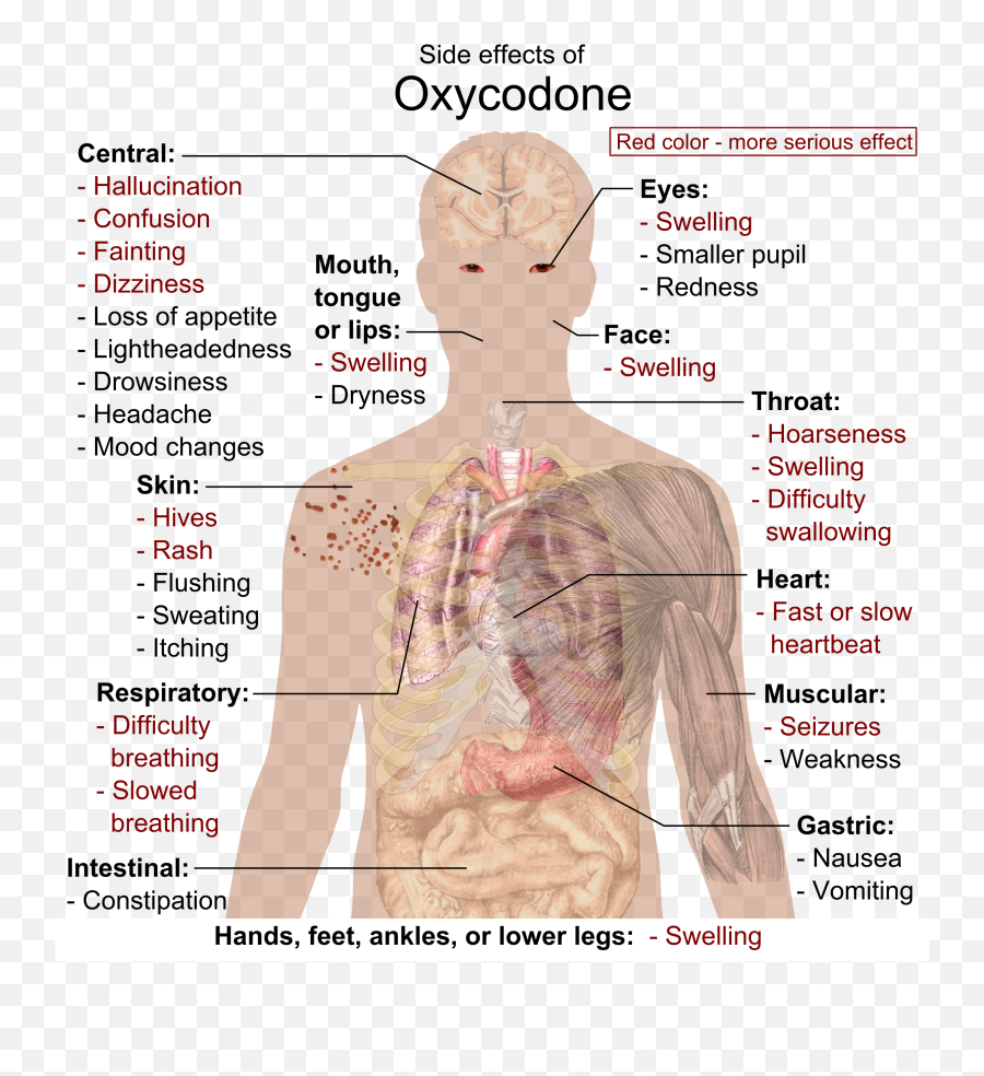 Side Effects Of Oxycodone - Physical Effects Of Opioid Use Emoji,Vomiting Emoji Gif