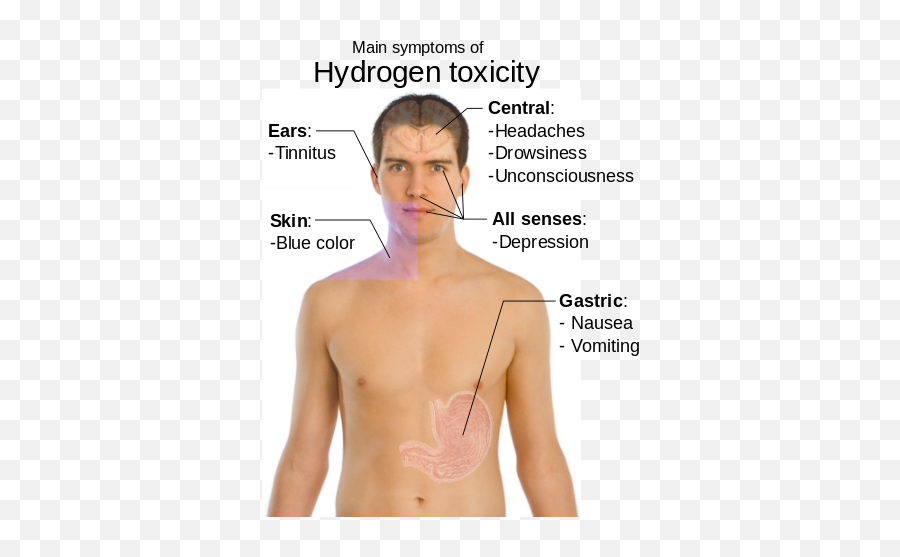 Main Symptoms Of Hydrogen Toxicity - Hydrogen Toxicity Emoji,Chin Scratch Emoji