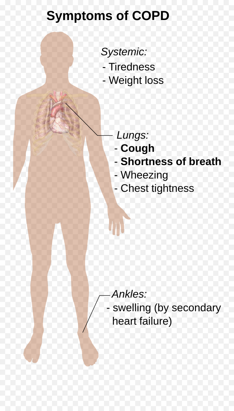 Symptoms Of Copd - Copd Symptoms Emoji,Sleeping Emoji Copy And Paste