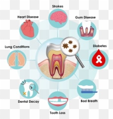Gum In Mouth Clipart - Oral Health Art Emoji