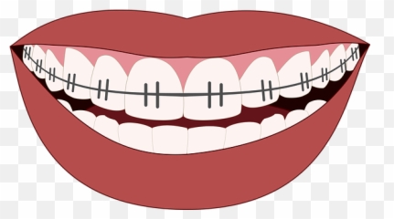 Braces Clipart Smile Person Picture - Cartoon Mouth With Braces Emoji,Missing Tooth Emoji