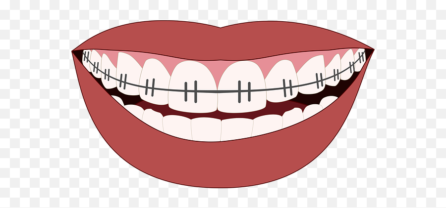 Braces Clipart Smile Person Picture - Cartoon Mouth With Braces Emoji,Missing Tooth Emoji