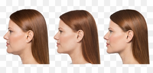 Shrink It Emoji,Double Chin Emoji