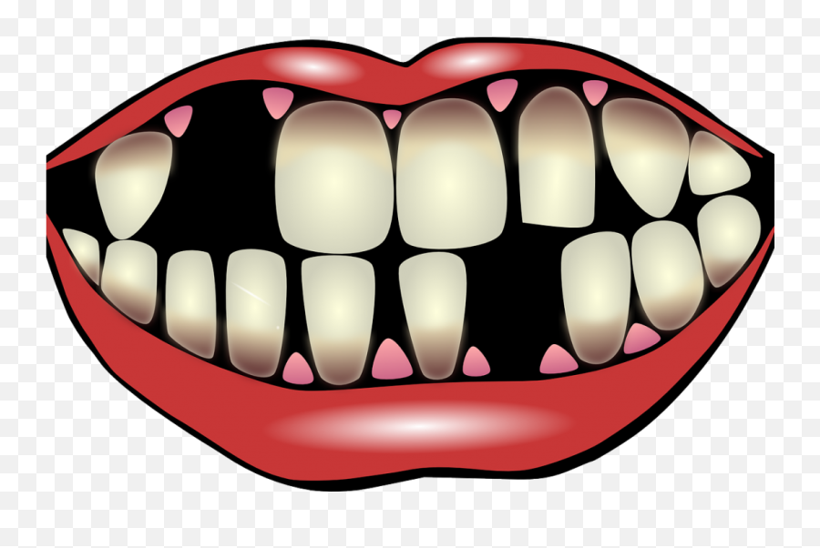 Gum Clipart Theeth Gum Theeth - Missing Teeth Clipart Emoji,Toothache Emoji