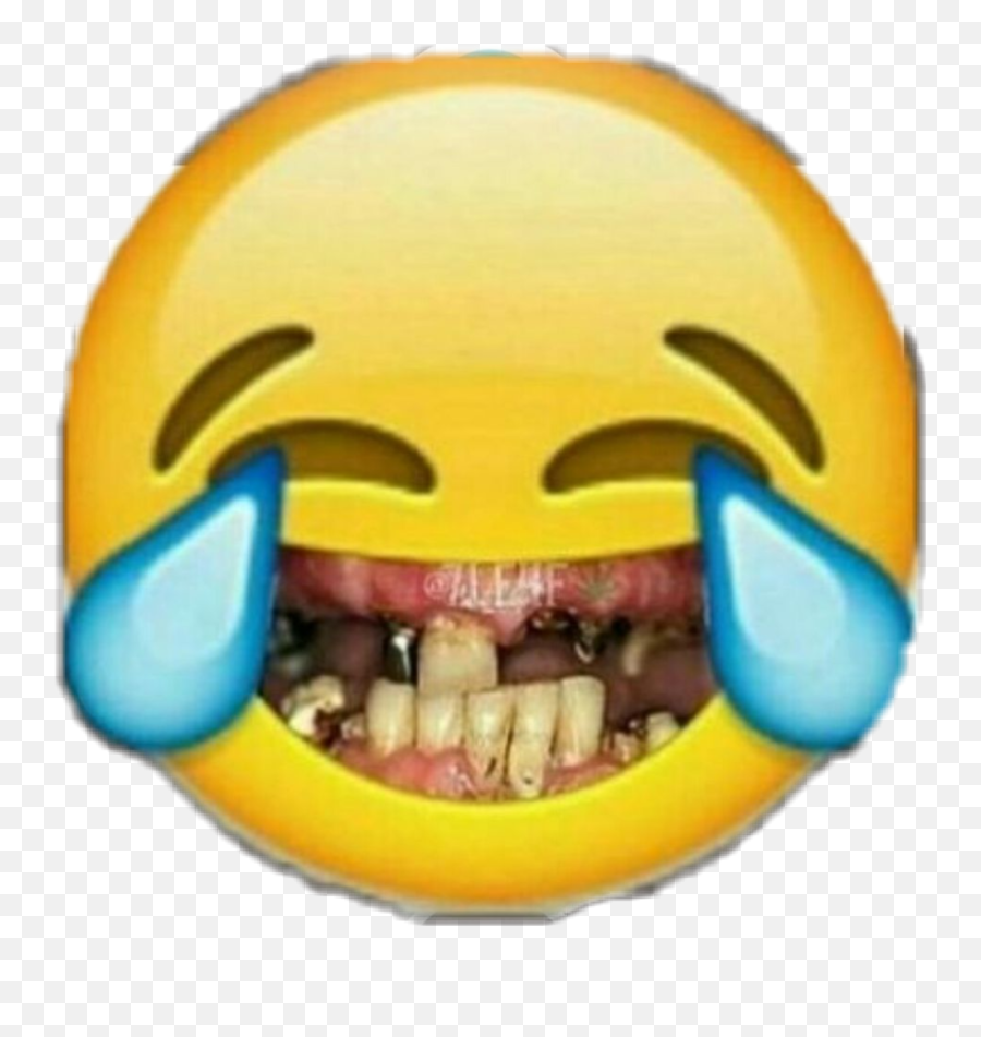 Emoji Funny Sad Omg Happy Smile - Laughing Emoji With Bad Teeth,Funny Emoji