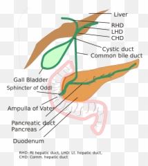 Biliary System - Choledochal Cyst Types Emoji