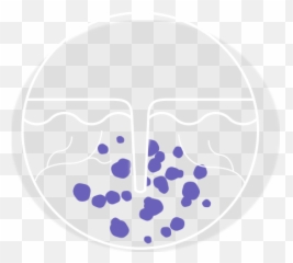 Restylane - Circle Emoji,Snooty Emoji