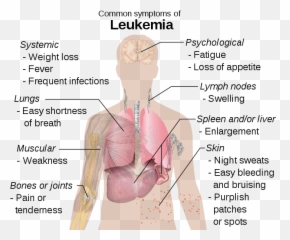 Symptoms Of Leukemia - Emoji