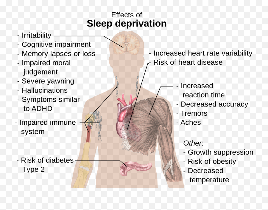 Effects Of Sleep Deprivation - Symptoms Of Iron Deficiency Anemia Emoji,Shoulder Shrug Emoji