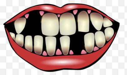 Kiss Me - Missing Teeth Clipart Emoji