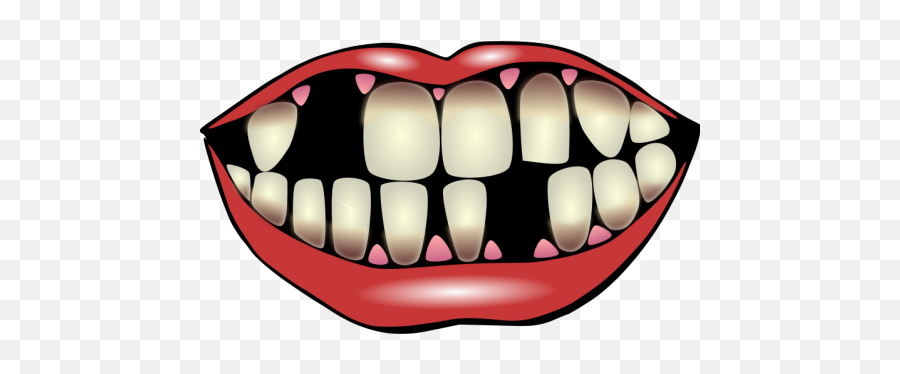 Kiss Me - Missing Teeth Clipart Emoji,Magnet Emoji