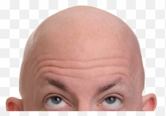 Bald - Bold Hair Png Emoji,Bald Emoji