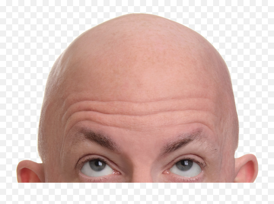 Bald - Bold Hair Png Emoji,Bald Emoji