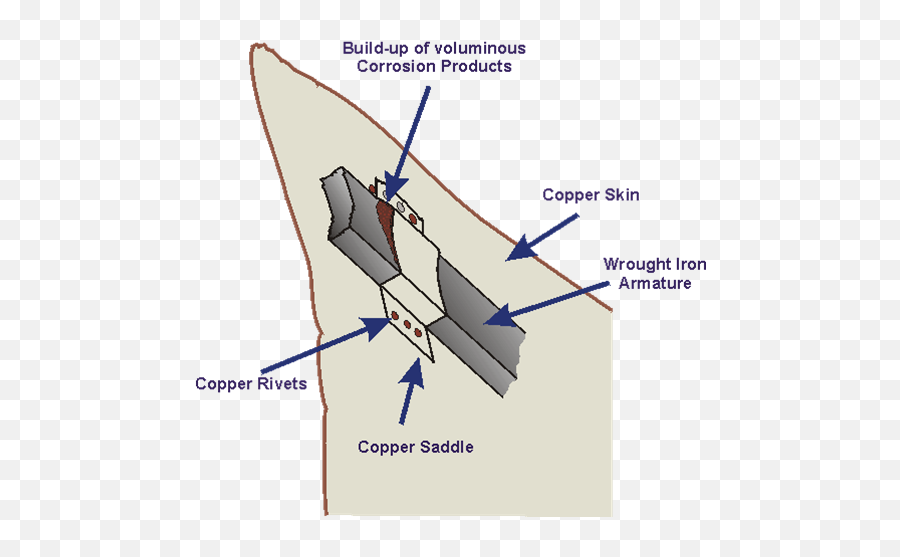 Statue Lib Corr1 - Galvanic Corrosion Examples Emoji,Emoji Statue Of Liberty