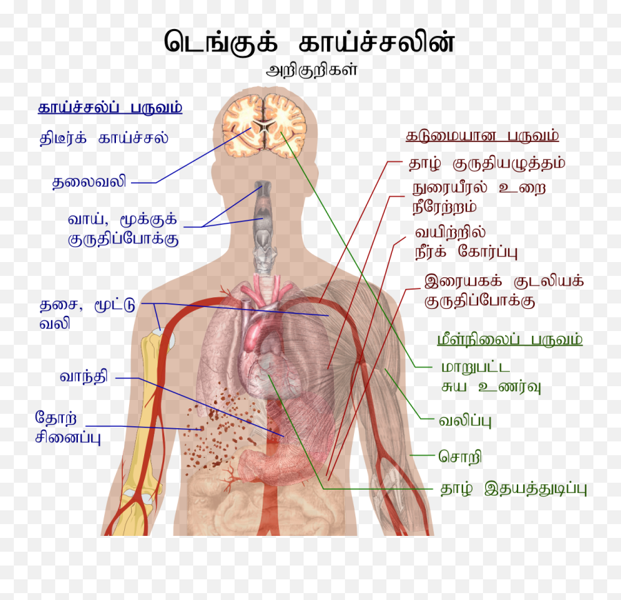 Dengue Symptoms In Tamil Emoji,Emoji Meanings