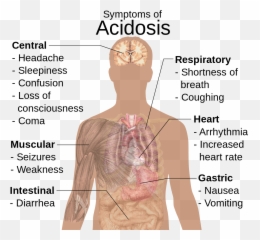 Symptoms Of Acidosis - Symptoms Of Acidosis Emoji,Shoulder Shrug Emoji