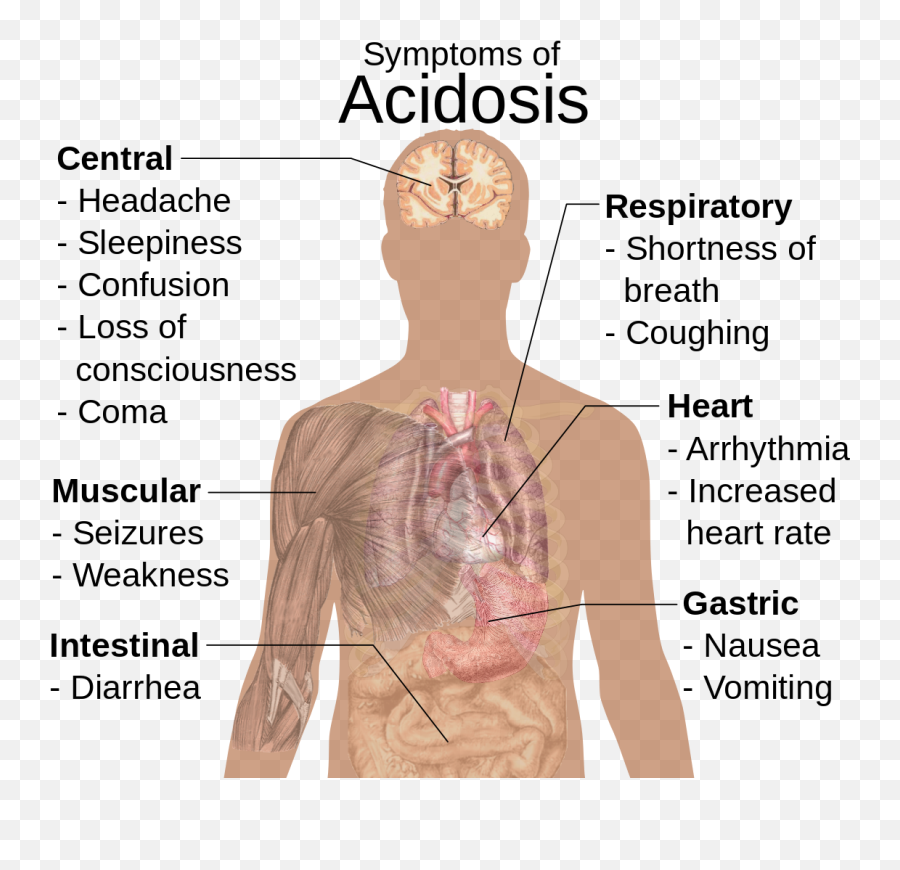 Symptoms Of Acidosis - Symptoms Of Acidosis Emoji,Shoulder Shrug Emoji